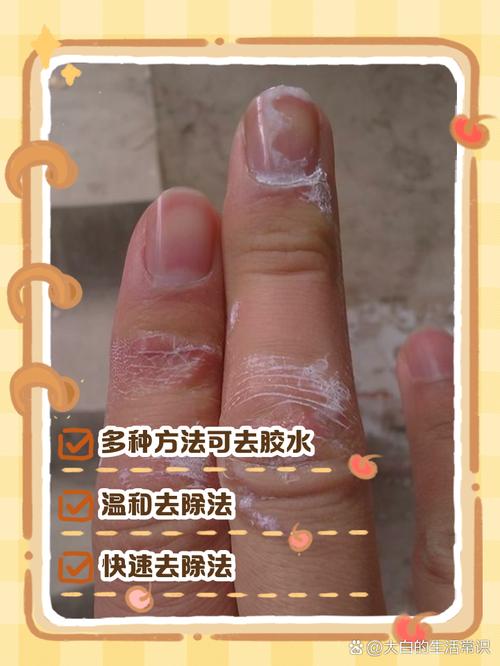 真不小心沾了，该怎么脱身？