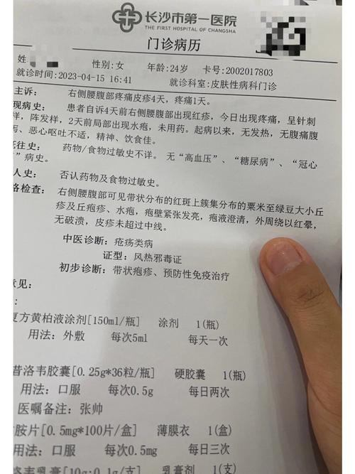 皮肤科医生诊断带状疱疹腰部皮疹