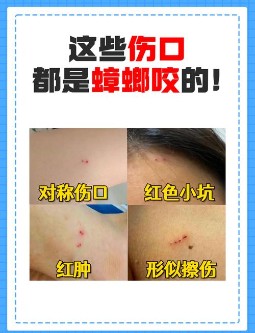 处理咬人打人最容易踩的三个坑