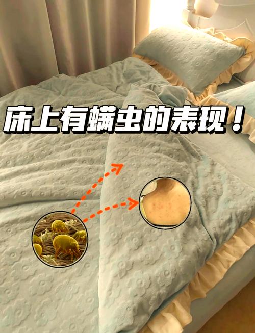 家用床垫尘螨分布显微镜观测图