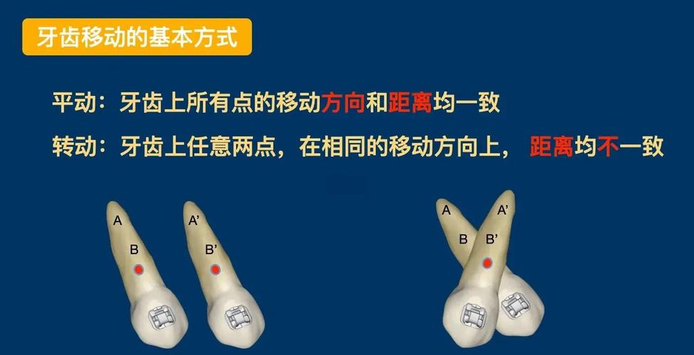 先分清你要哪种“移动”方式