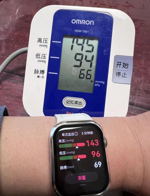 智能手表与传统血压计对比测量场景