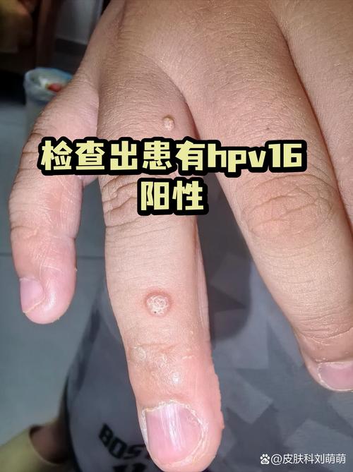 查出风险，接下来该怎么动？