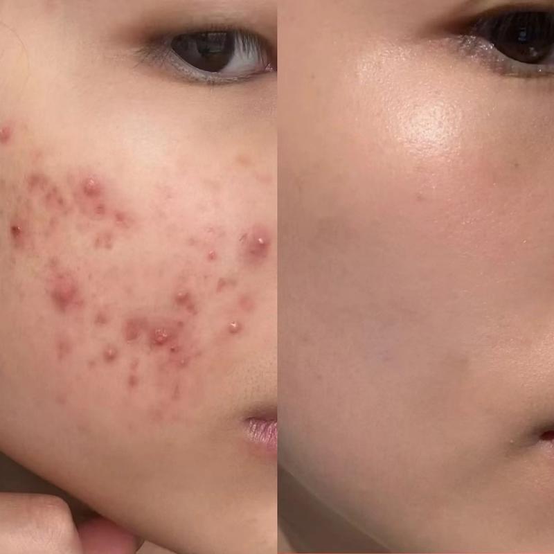 显微镜下放大的青春痘与干净脸部皮肤对比