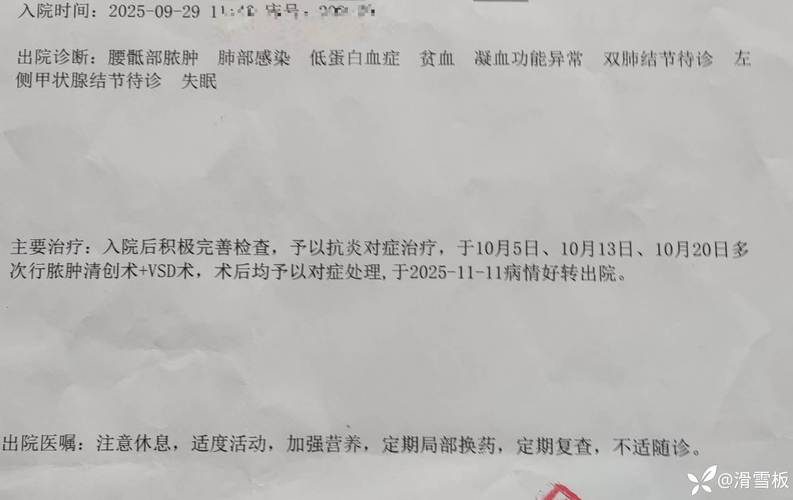 并发压测下的血淋数据:为什么我说它不可原谅