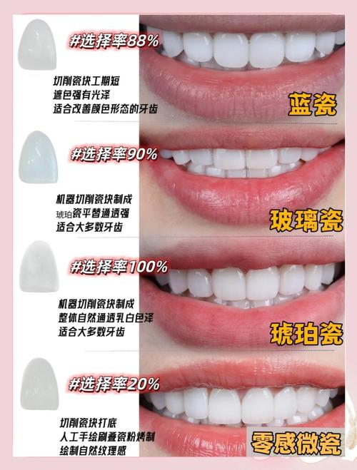 冷光、牙贴、牙套……到底选哪个才不踩坑