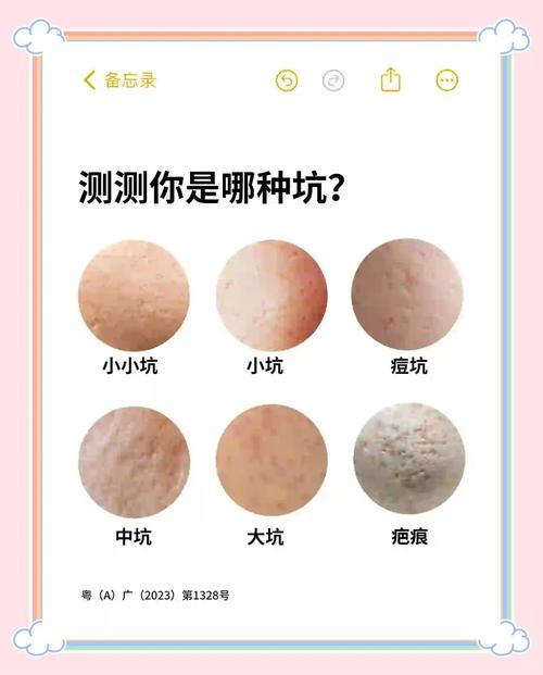 三、关于颜值和保养的坑