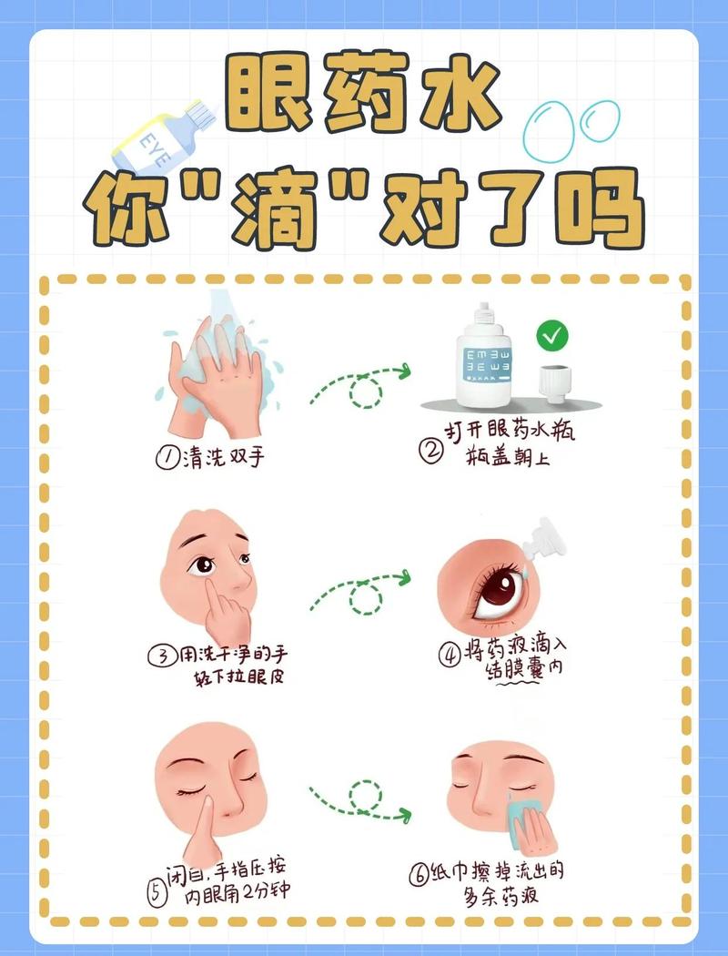 给猫咪滴眼部抗病毒药的正确手法