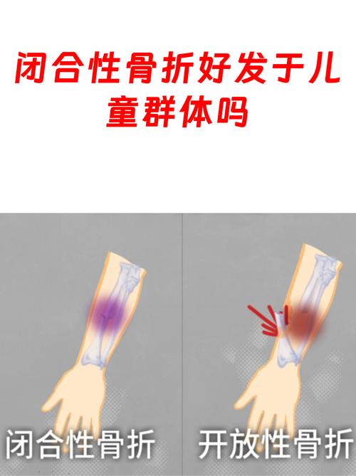 宠物闭合性骨折与开放性骨折的对比示意图