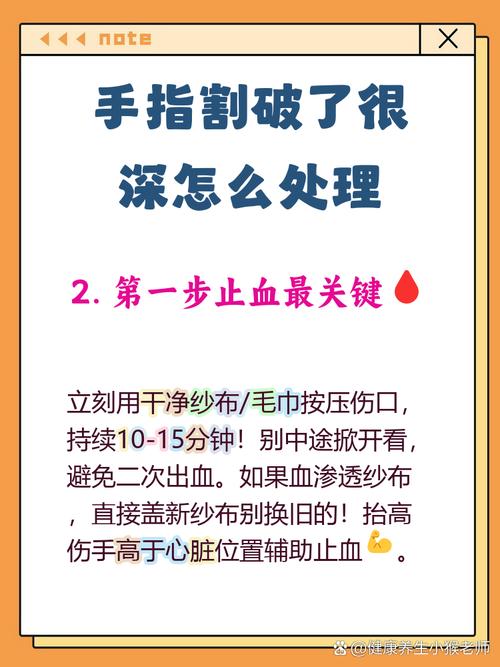 车间急救员演示手指割伤止血包扎步骤图