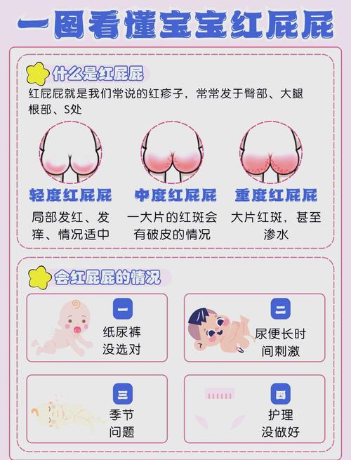 不能在家扛的宝宝臀部护理就医红线
