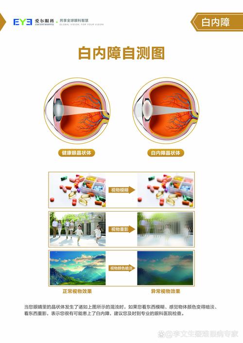 老年性白内障早期视物朦胧对比图