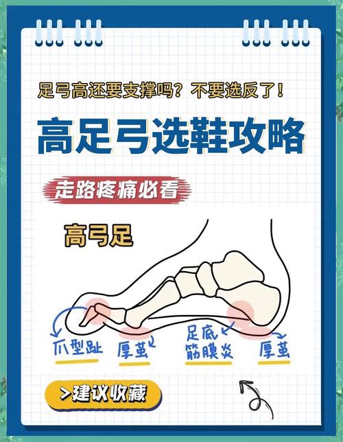 选型误区：三个坑，踩一个就够受的