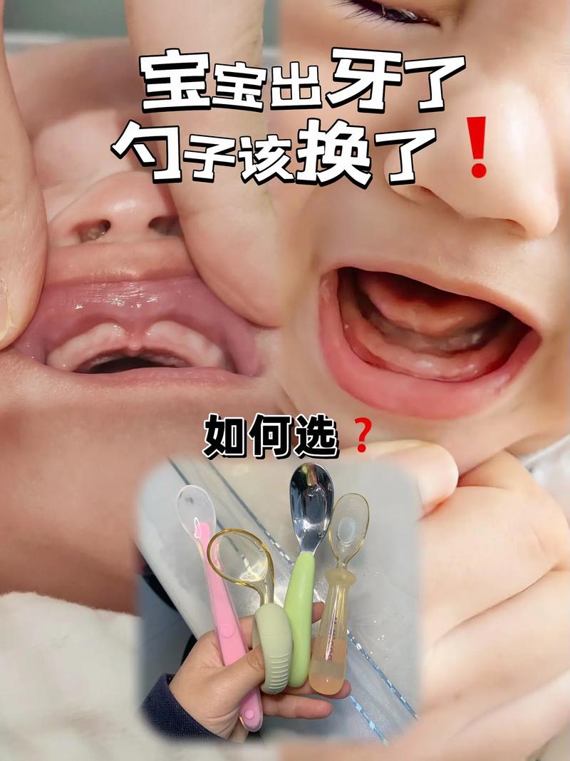 一岁宝宝出牙期咬敲碗筷实拍图