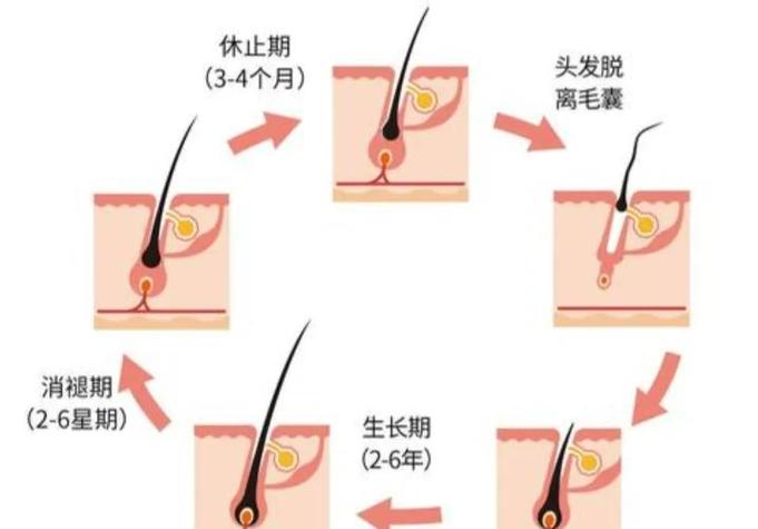 产后女性休止期脱发毛囊周期示意图