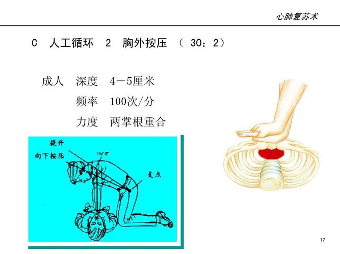 工业车间CPR按压深度示意图