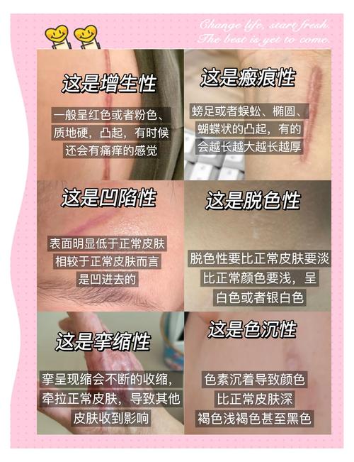 什么时候该“有痕”？分界线在哪儿