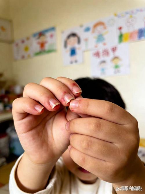 儿童在课堂上感受到同辈压力啃手指甲特写