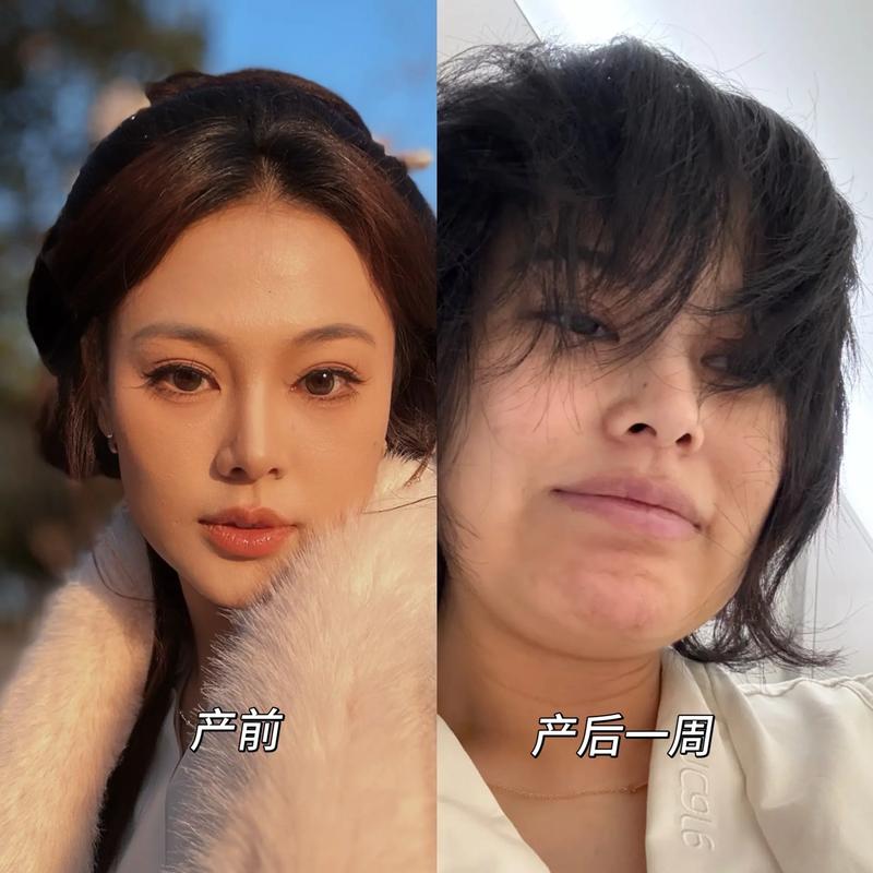 产后抑郁妈妈表面微笑内心崩溃对比图