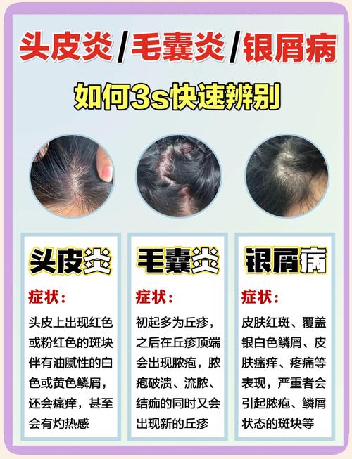 健康头皮与问题头皮对比图