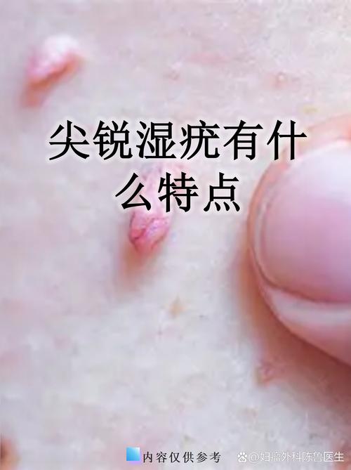 尖锐问题：普通人常踩的坑