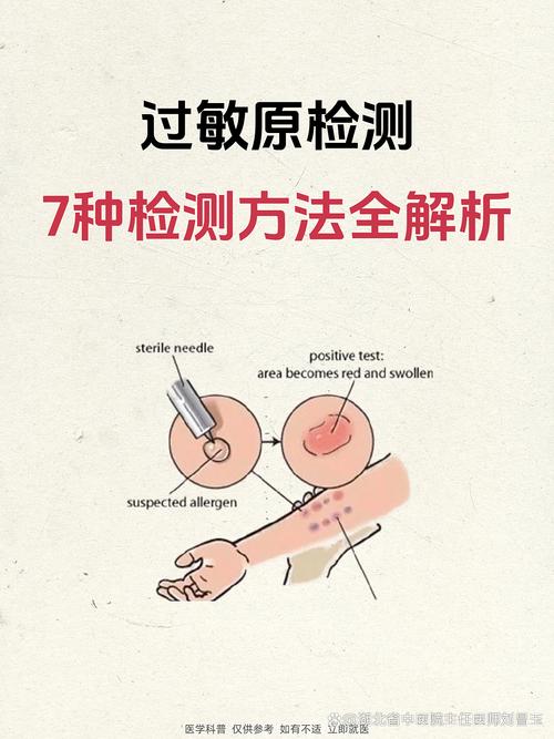三、过敏原检测,到底要不要做?