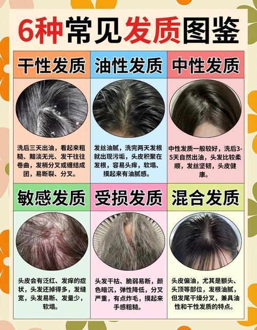 发质和发量——Tony老师想说却不敢说的