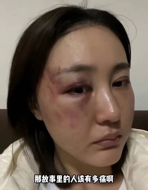 家庭暴力受害人手机保存的脸部伤情实拍图