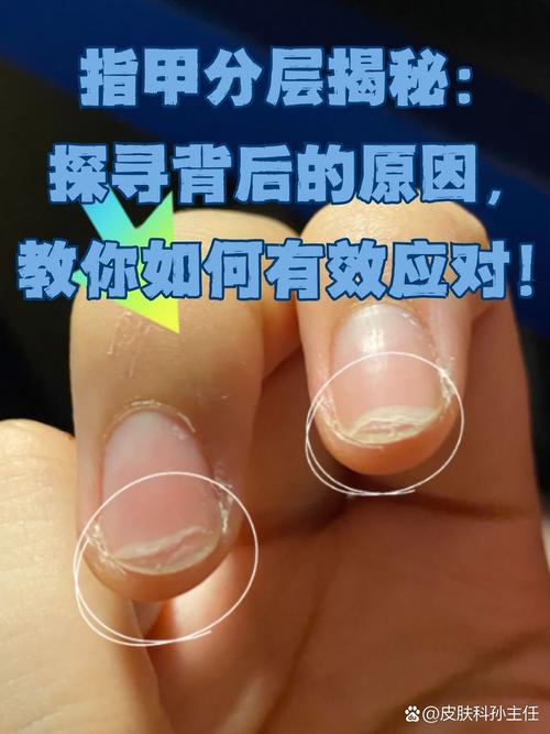 分层的边界，别贴隐形标签