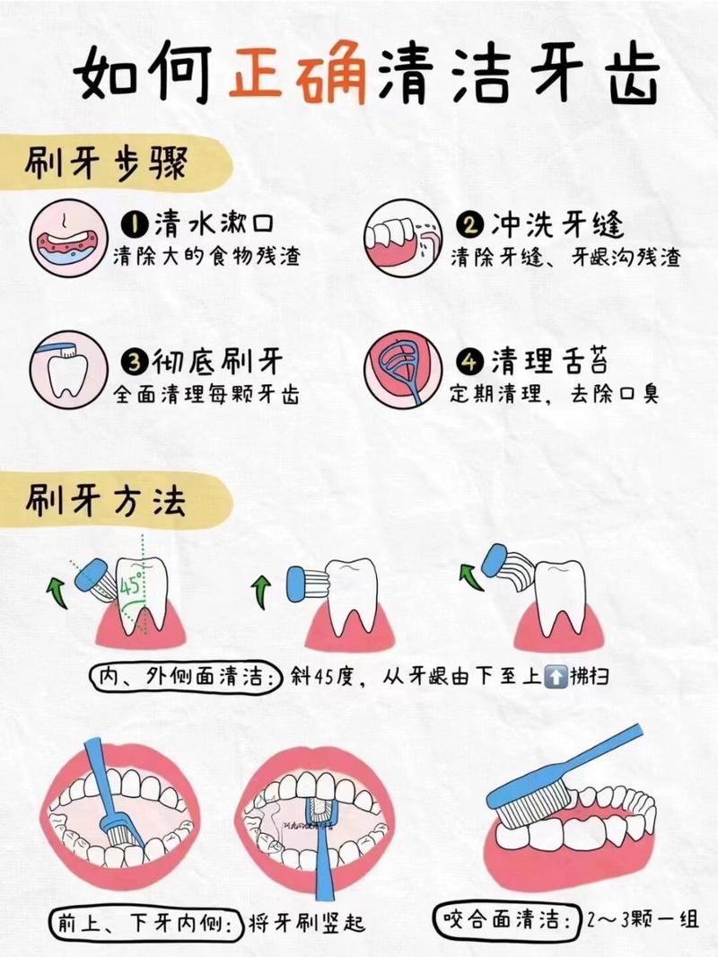 牙周炎患者牙缝清洁示意图