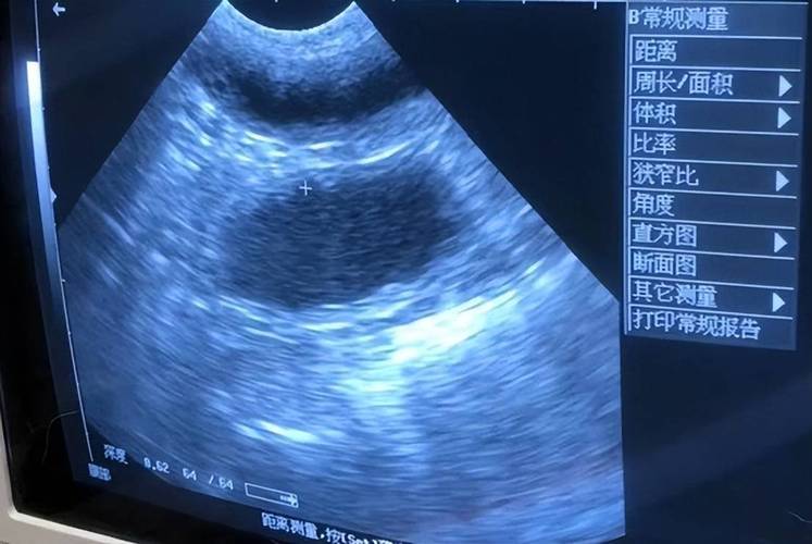 发情母狗子宫蓄脓超声影像