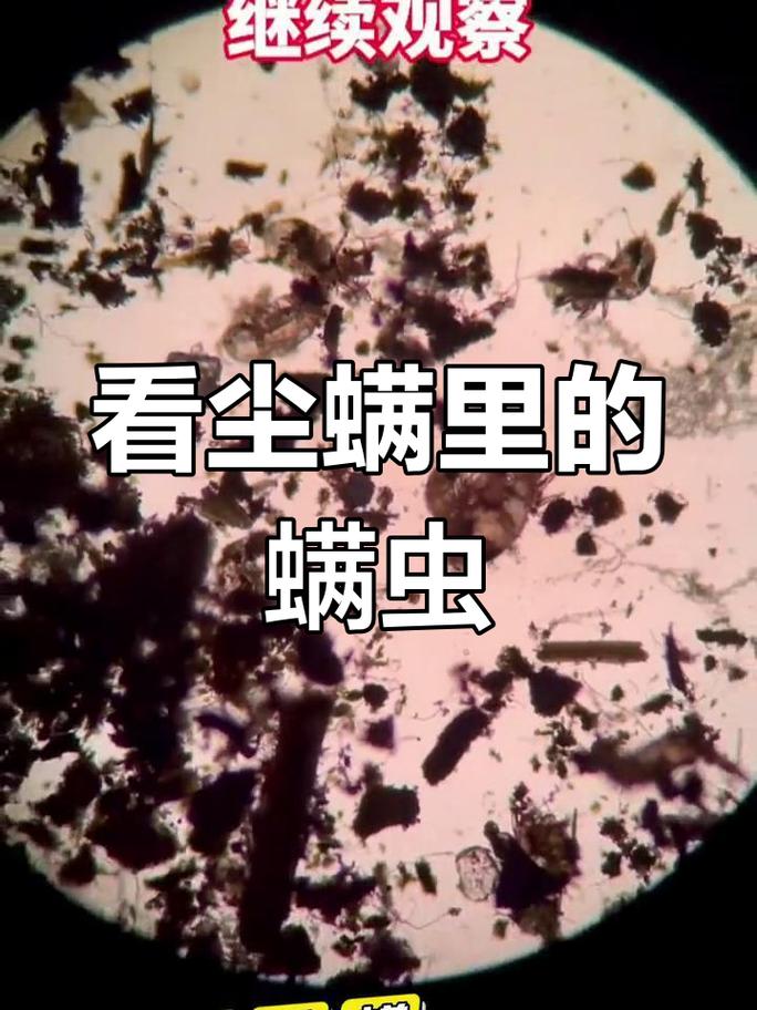 密闭衣柜收纳保暖用品后滋生螨虫显微镜图