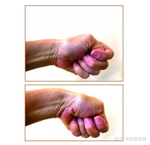 刷完怎么查,别留后遗症