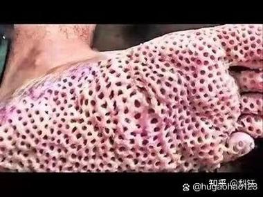 那些让我头皮发麻的坑