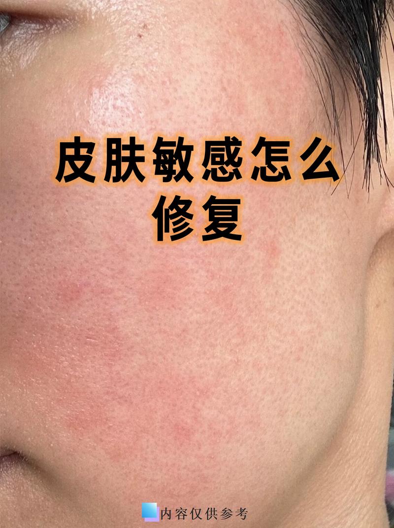 除了脸，这些地方的保湿别漏了