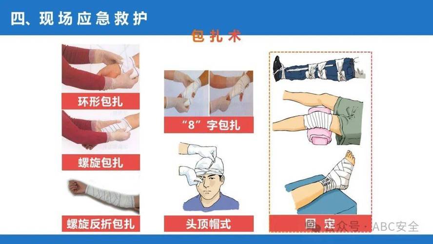 工业安全生产现场止血包扎操作示意图