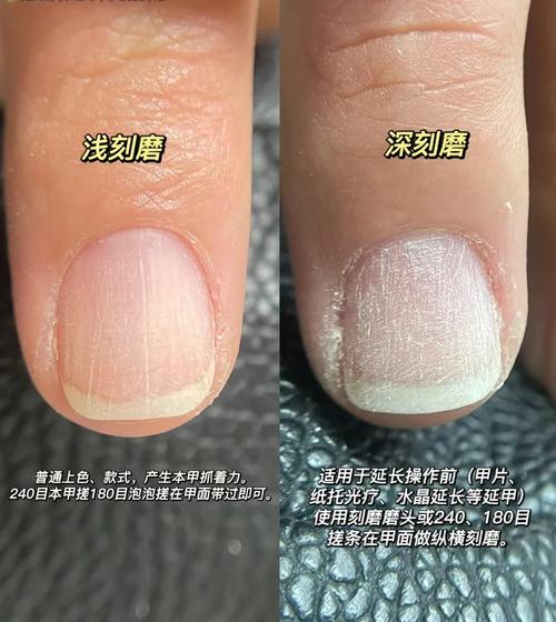 过度打磨后受损指甲对比图