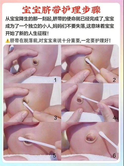 脐带护理:别怕,就是有点可怕