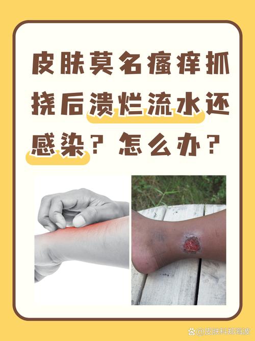 最后的硬伤：细菌不是傻子，你会过敏