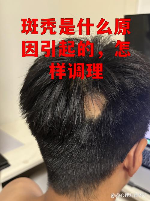 为什么高粘性物料让人头秃