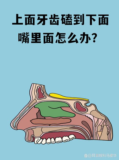 普通人碰到这事，该往哪下嘴？