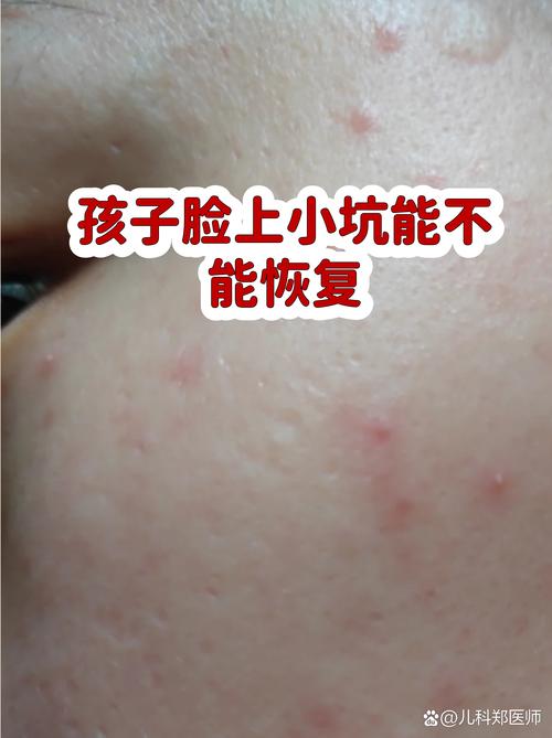 很多家长容易踩的几个小坑