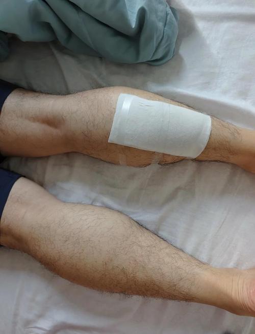 普通人运动后小腿肌肉拉伤休息场景实拍