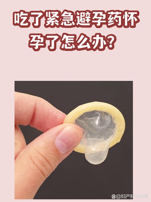 我劝你别等“意外怀孕”了才想起避孕