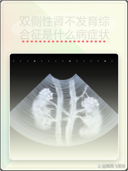 婴幼儿肾脏发育程度对比图