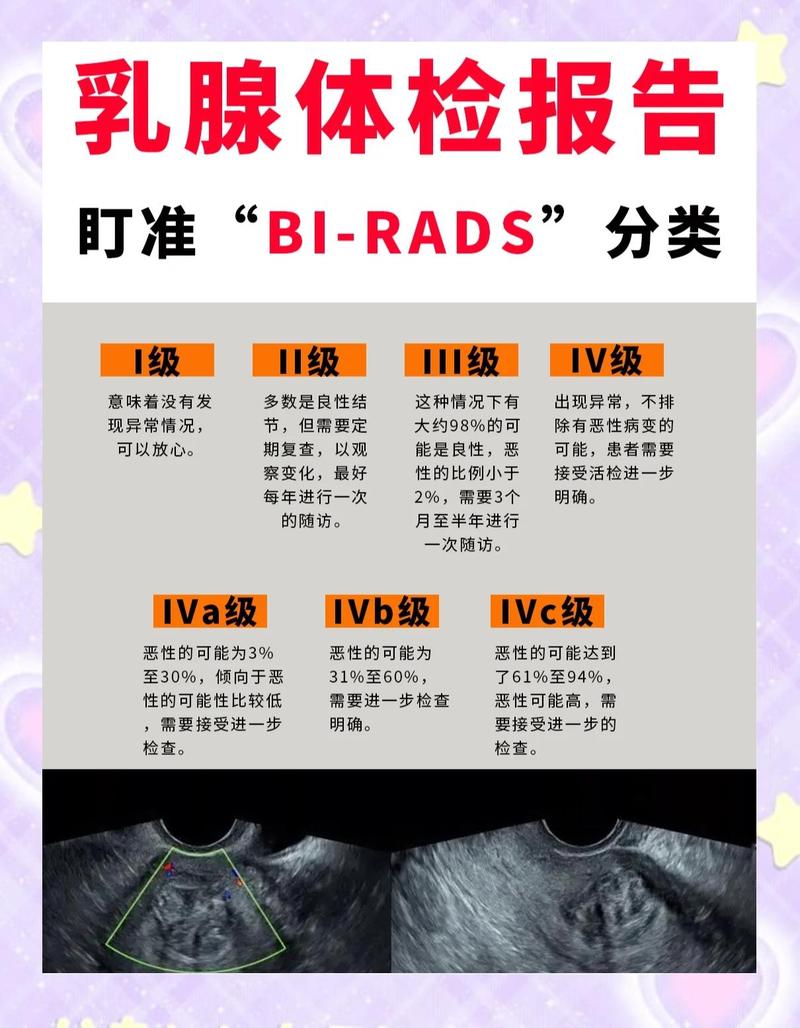 体检报告常见结节异常标注示意图