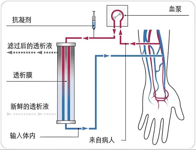 透析液平衡腔隔膜工作原理图