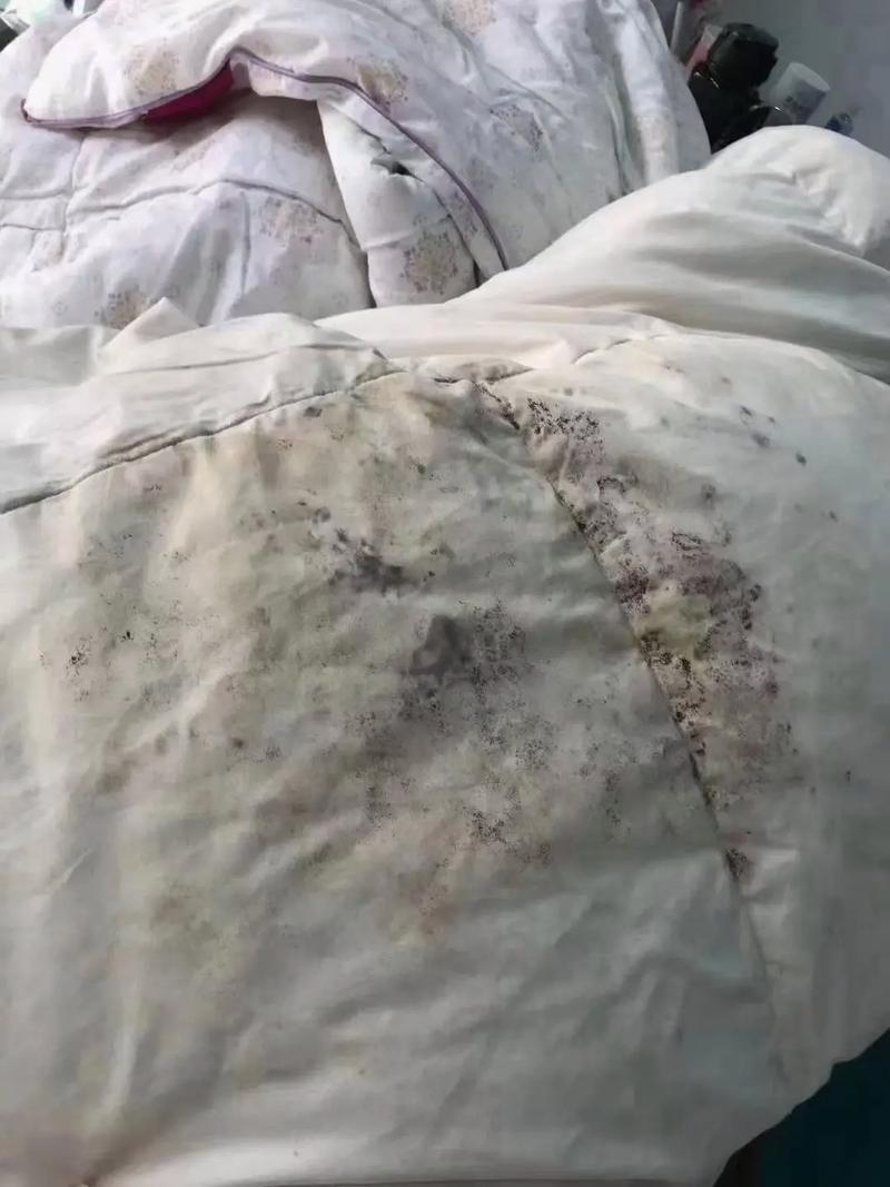 堆积衣物中的尘螨特写照片