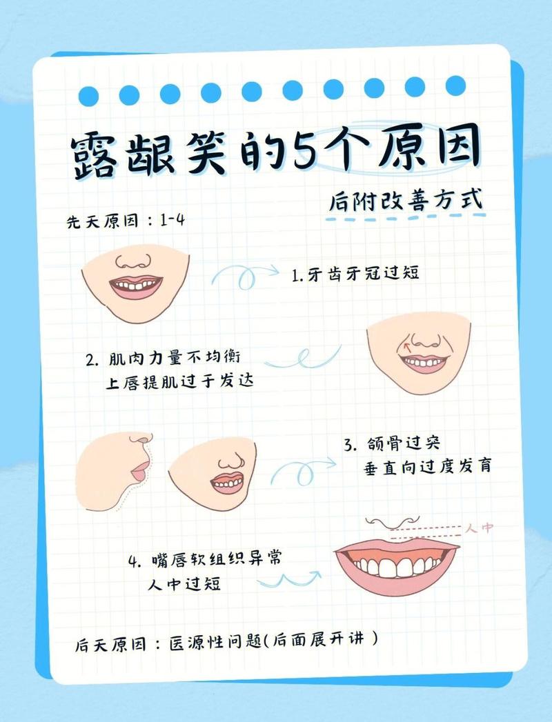 大笑疗法的几个小误区一定要避开