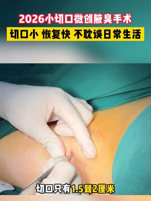 不用报班，日常就能练的小切口